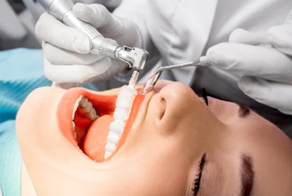 Ultrasonic Scaling