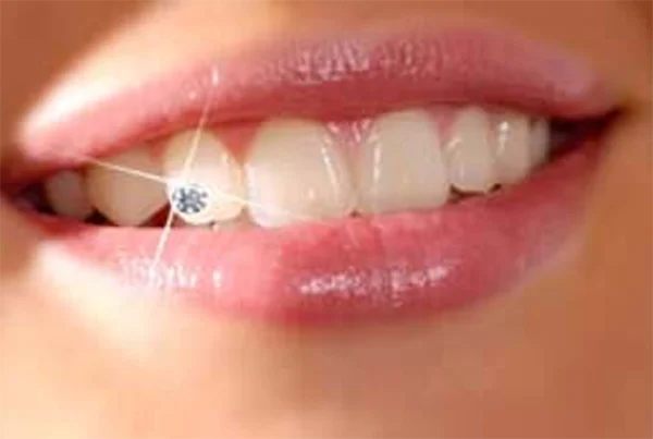 Tooth Jewellery