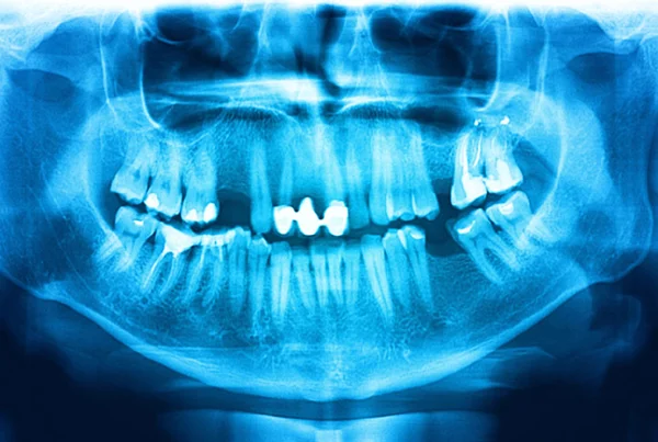 Digital X Ray