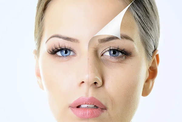 Anti Aging